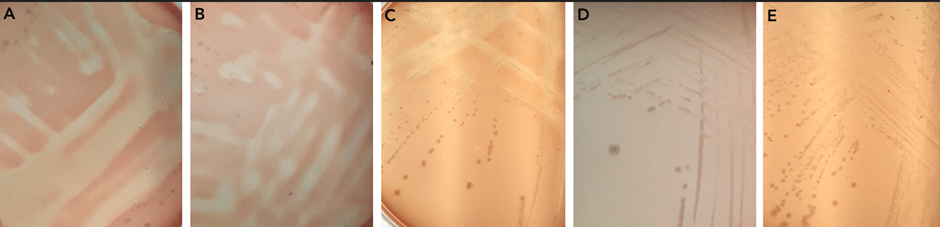 Areas of lysis of red blood cells in the agar plates are seen in panels A, B, and C. However, when pla is knocked out there is no red blood cell lysis as seen in panels D and E.