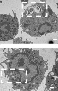 In the top panel, taken from an electron microscopy image, there is a clear region within the neutrophil cell where the N. gonorrhoeae bacteria are in a vacuole, which appears compromised. An uncompromised vacuole can be seen in the bottom image, where the gonococcal cells are contained within a neutrophil vacuole.